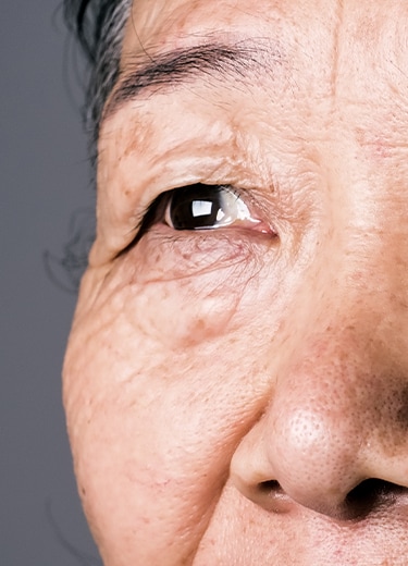 BANNER_DIABETESPERDAVISAO_375x520